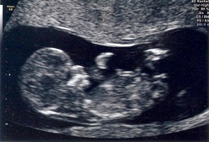 20121030 Baby Scan